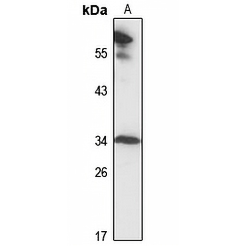 MRPL2 Rabbit Polyclonal Antibody