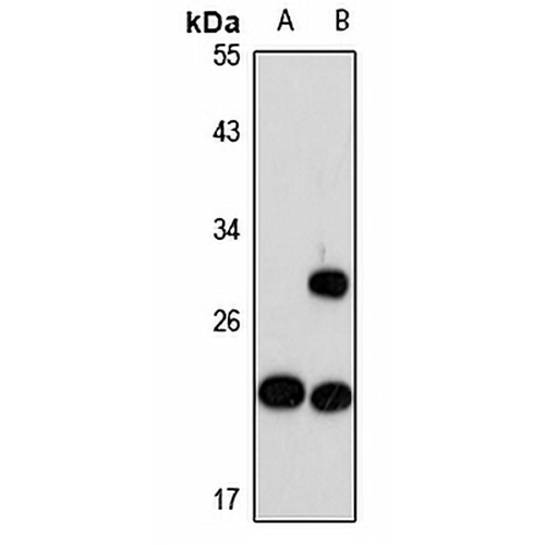 MRPS26 Rabbit Polyclonal Antibody