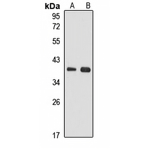 MRPS31 Rabbit Polyclonal Antibody