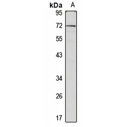 Mesothelin Rabbit Polyclonal Antibody