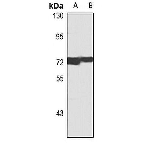 MTA2 Rabbit Polyclonal Antibody