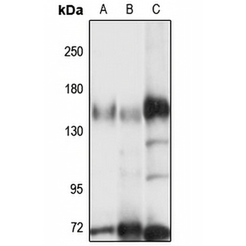 MTMR4 Rabbit Polyclonal Antibody
