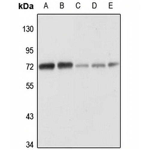MTMR6 Rabbit Polyclonal Antibody