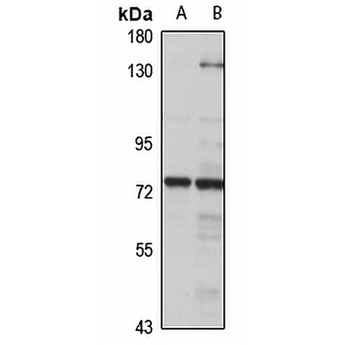 MTMR8 Rabbit Polyclonal Antibody