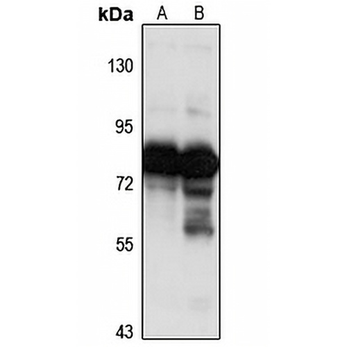 MTRR Rabbit Polyclonal Antibody