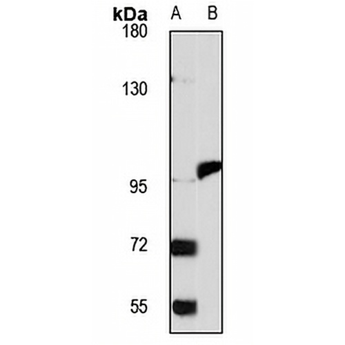 MTTP Rabbit Polyclonal Antibody