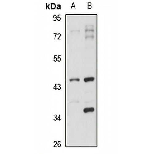 MVD Rabbit Polyclonal Antibody