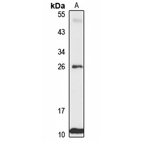 MTLC Rabbit Polyclonal Antibody