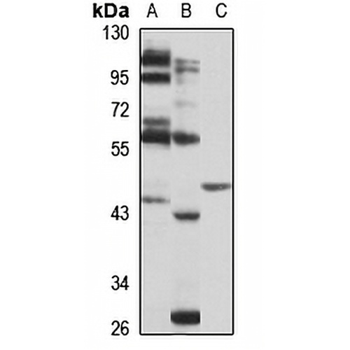 MYLK4 Rabbit Polyclonal Antibody