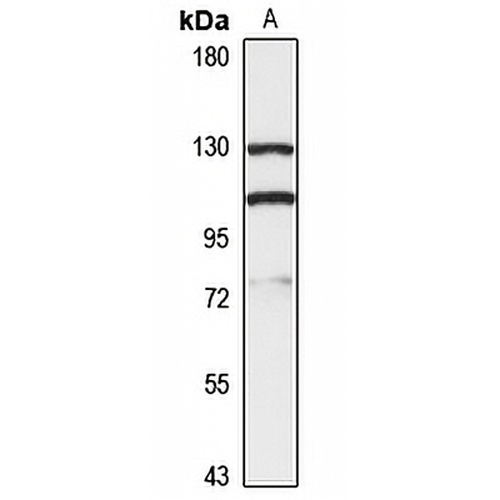 MYO1E Rabbit Polyclonal Antibody