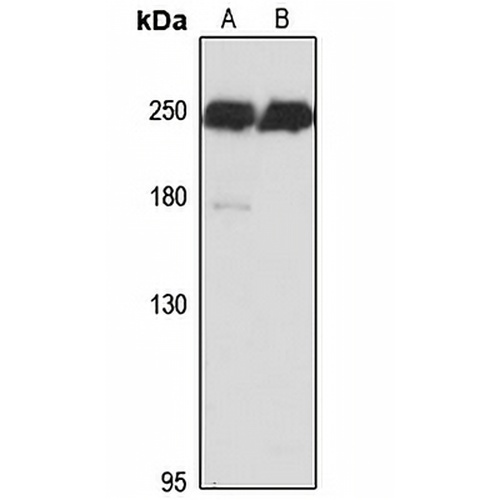 Myoferlin Rabbit Polyclonal Antibody
