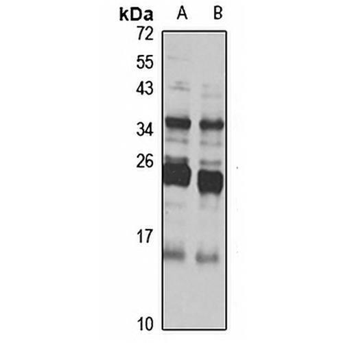 N6AMT2 Rabbit Polyclonal Antibody