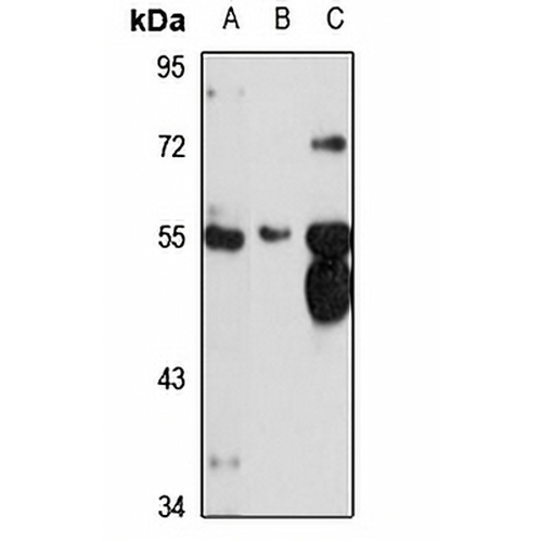 NAGS Rabbit Polyclonal Antibody