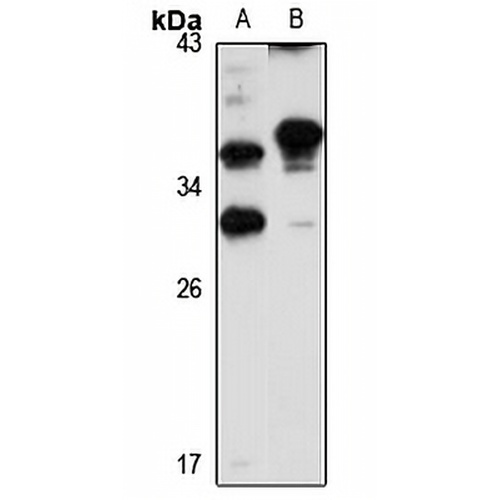 NAT-2 Rabbit Polyclonal Antibody
