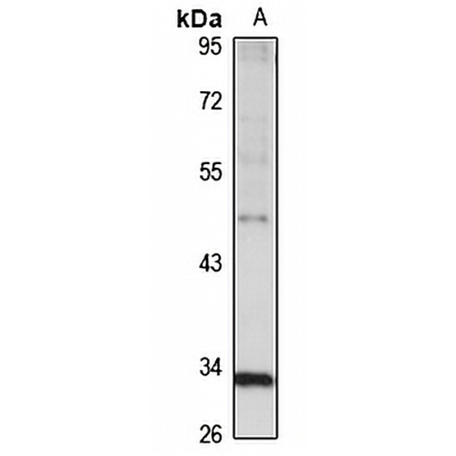 AADACL1 Rabbit Polyclonal Antibody