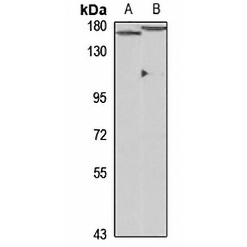NCOA1 Rabbit Polyclonal Antibody