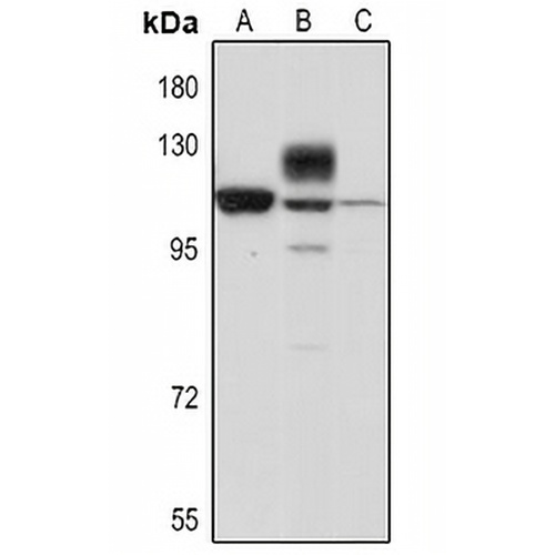 Nicastrin Rabbit Polyclonal Antibody