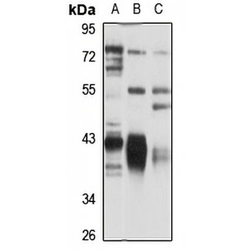 NDUFA10 Rabbit Polyclonal Antibody
