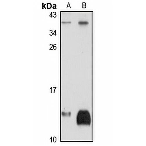 NDUFAB1 Rabbit Polyclonal Antibody