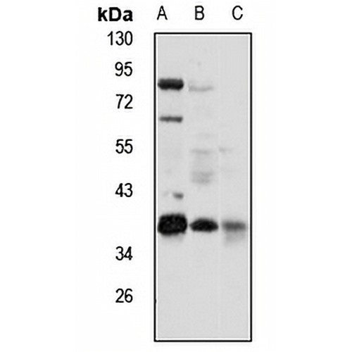 NDUFAF1 Rabbit Polyclonal Antibody