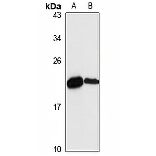 NDUFAF2 Rabbit Polyclonal Antibody