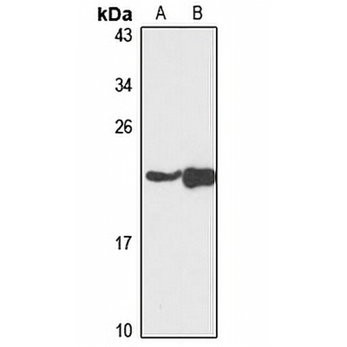 NDUFAF4 Rabbit Polyclonal Antibody