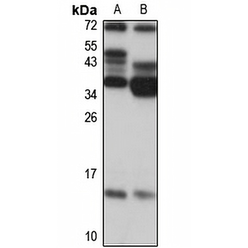 NDUFB3 Rabbit Polyclonal Antibody