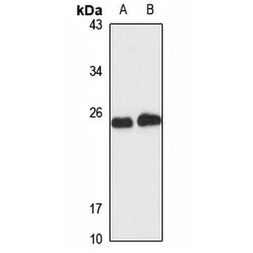 NDUFS8 Rabbit Polyclonal Antibody
