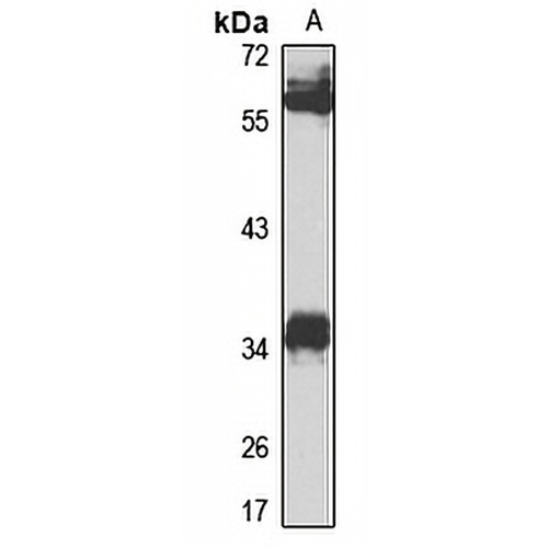 NEK6 Rabbit Polyclonal Antibody