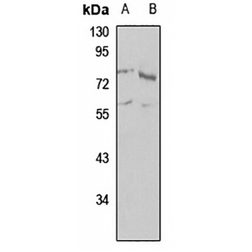 NEK8 Rabbit Polyclonal Antibody