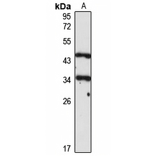 NF-1B Rabbit Polyclonal Antibody