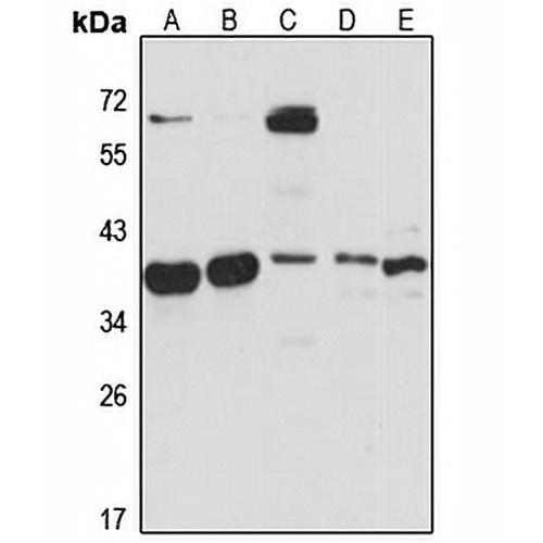 NGDN Rabbit Polyclonal Antibody