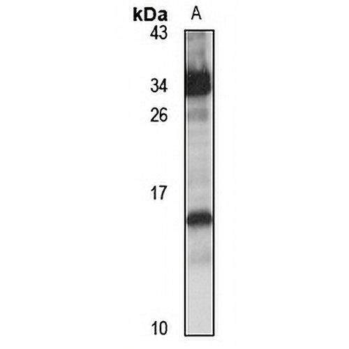 HEN1 Rabbit Polyclonal Antibody