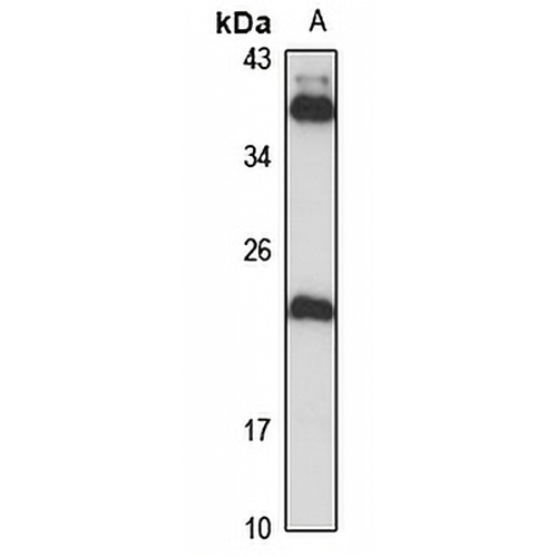 NHP2 Rabbit Polyclonal Antibody