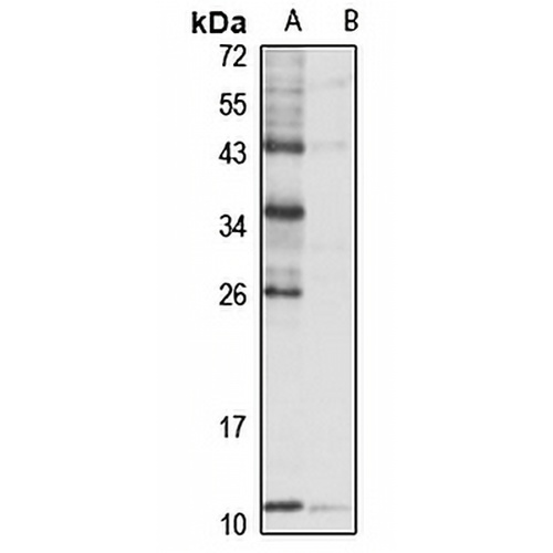 NHP2L1 Rabbit Polyclonal Antibody