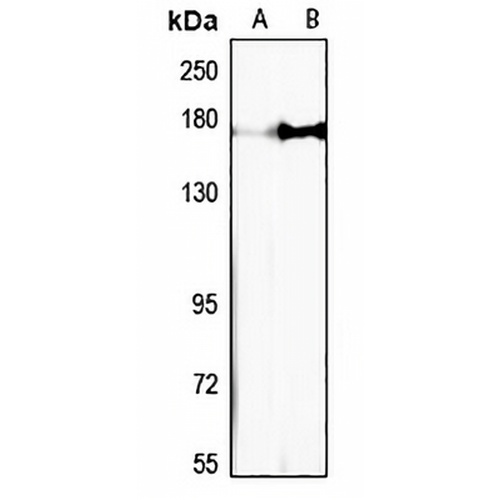Nischarin Rabbit Polyclonal Antibody