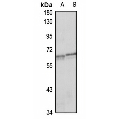 NLK Rabbit Polyclonal Antibody