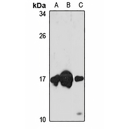 nm23-H2 Rabbit Polyclonal Antibody