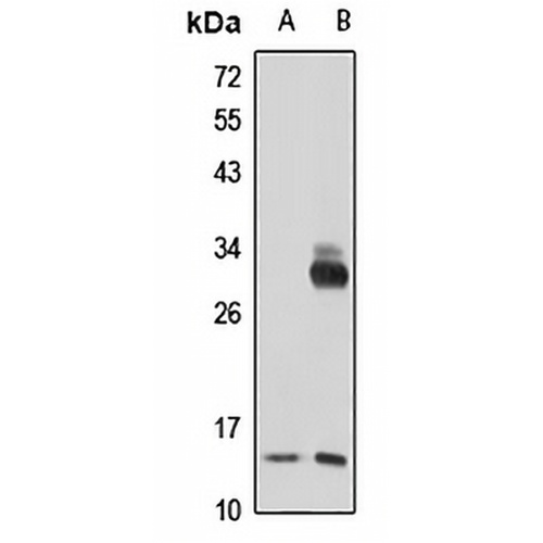 NM23-H3 Rabbit Polyclonal Antibody