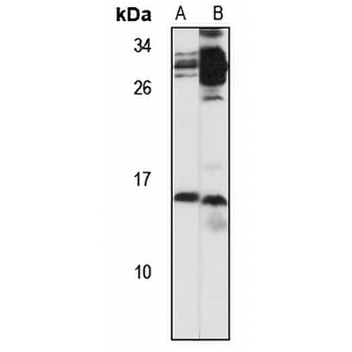 NPB Rabbit Polyclonal Antibody
