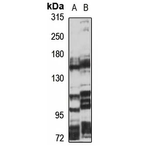 NPC1L1 Rabbit Polyclonal Antibody