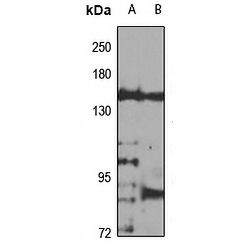 Nephrocystin-3 Rabbit Polyclonal Antibody