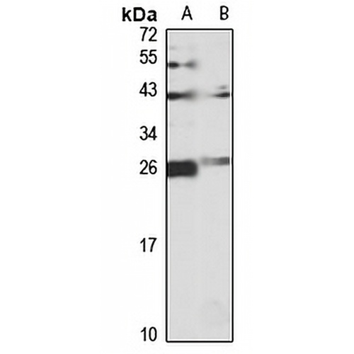 NQO2 Rabbit Polyclonal Antibody