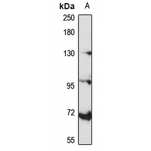 Mineralocorticoid Receptor Rabbit Polyclonal Antibody