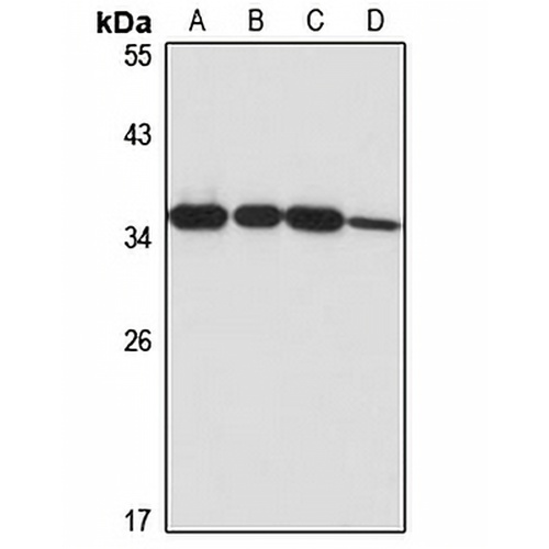 TINP1 Rabbit Polyclonal Antibody