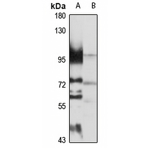 NSUN2 Rabbit Polyclonal Antibody
