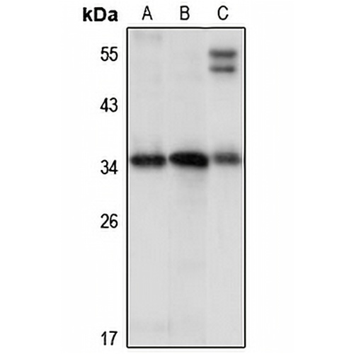 PNAD Rabbit Polyclonal Antibody