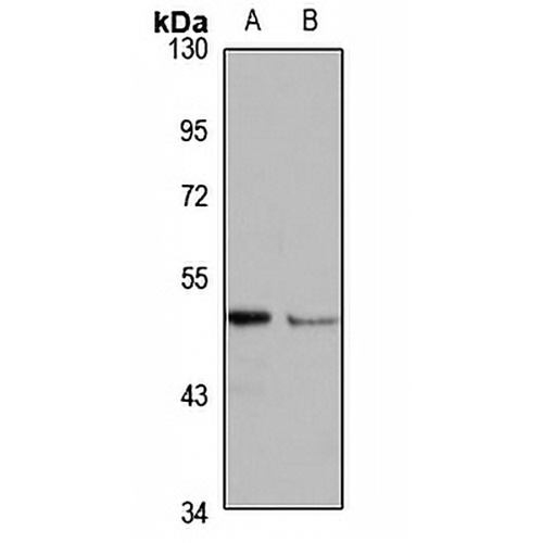 Netrin-5 Rabbit Polyclonal Antibody