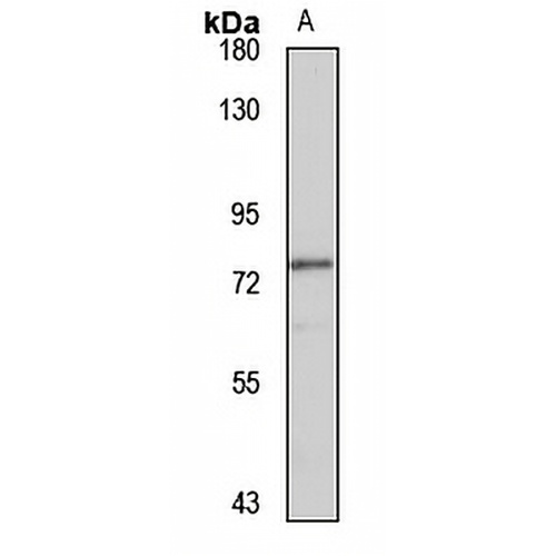 ARK5 Rabbit Polyclonal Antibody