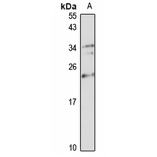 NUDT16 Rabbit Polyclonal Antibody